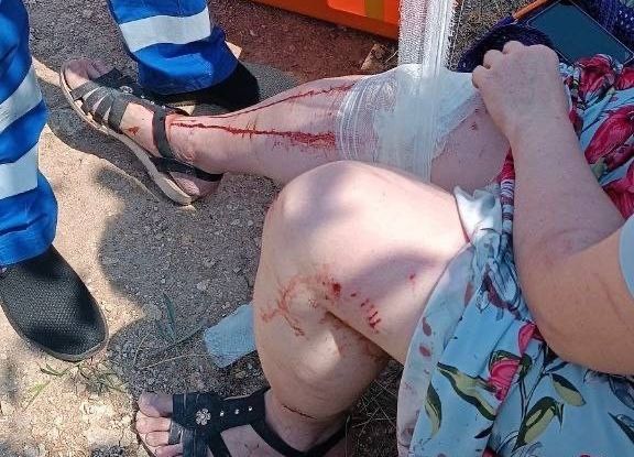 Две бойцовские собаки напали на жительницу Севастополя (видео 18+)